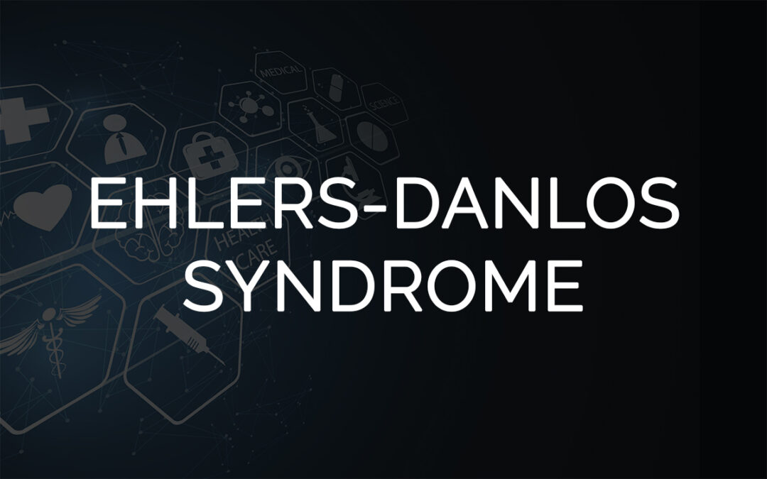 Patient Case Report 3: Ehlers Danlos Syndrome