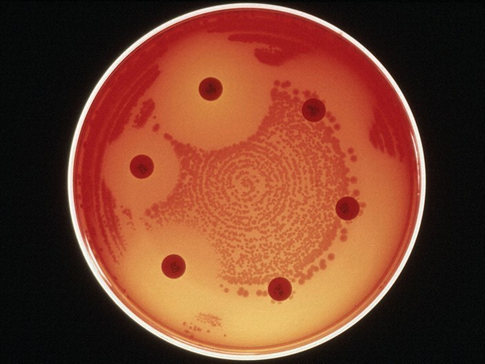 The Antibacterial Potential of Cannabinoids